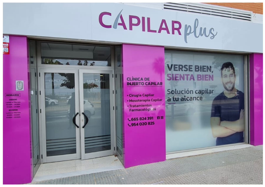INJERTO CAPILAR SEVILLA