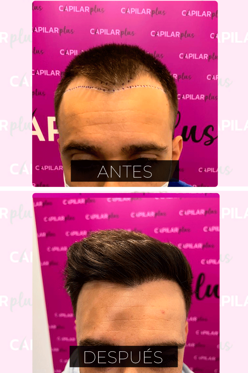 CLINICA CAPILAR PLUS SEVILLA