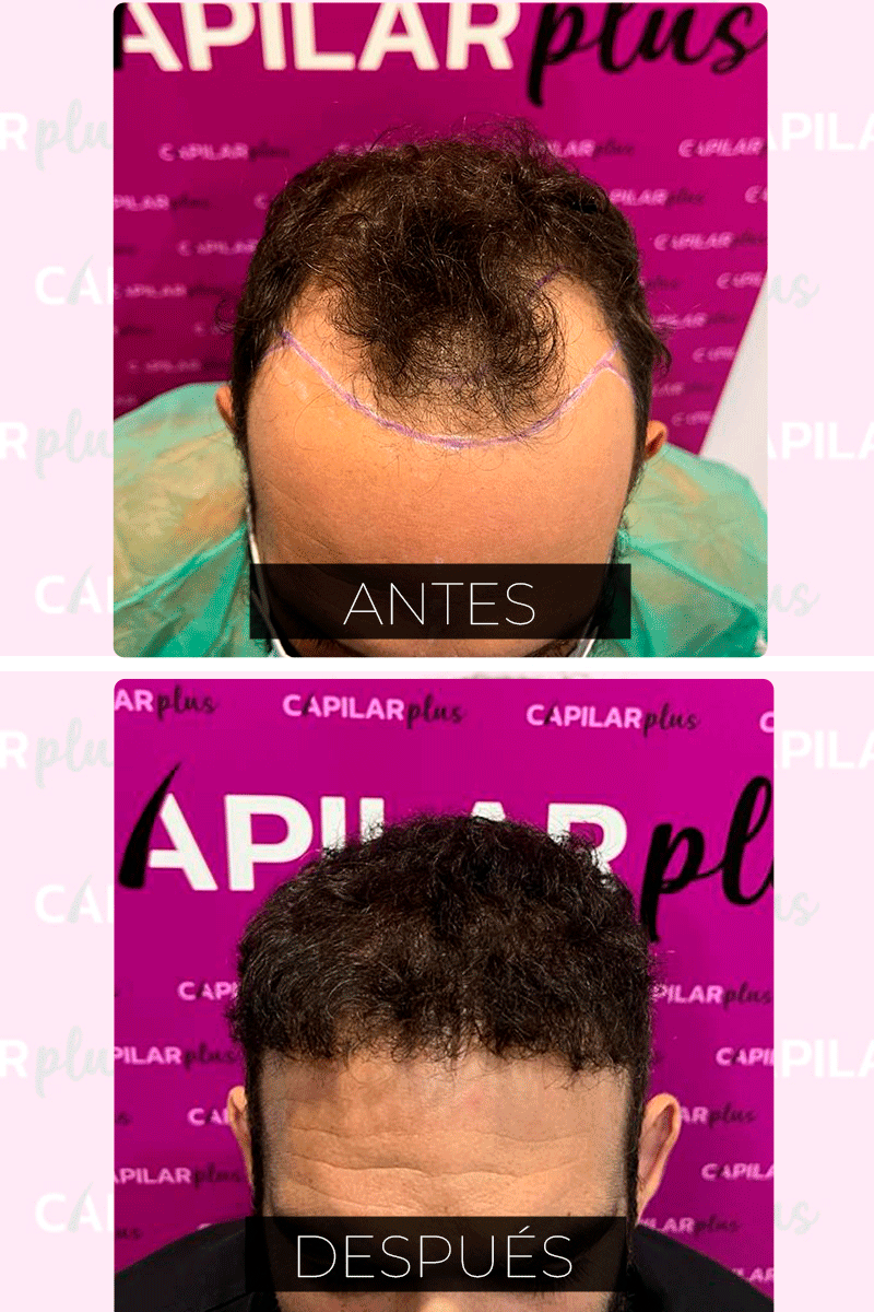DIAGNOSTICO CAPILAR SEVILLA
