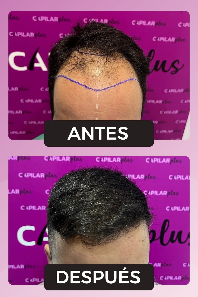 DIAGNOSTICO CAPILAR SEVILLA