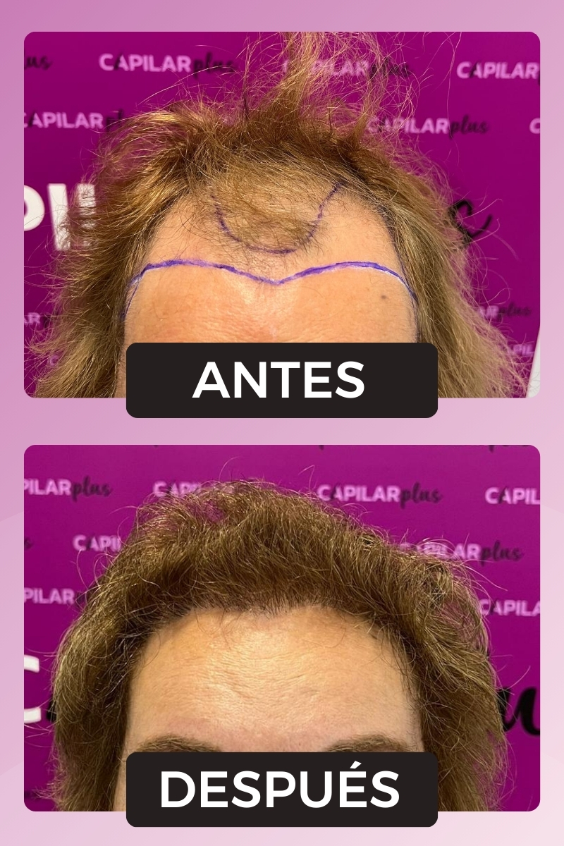 CLINICA CAPILAR PLUS SEVILLA