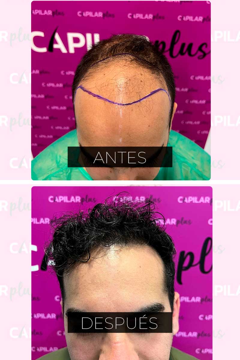 DIAGNOSTICO CAPILAR SEVILLA