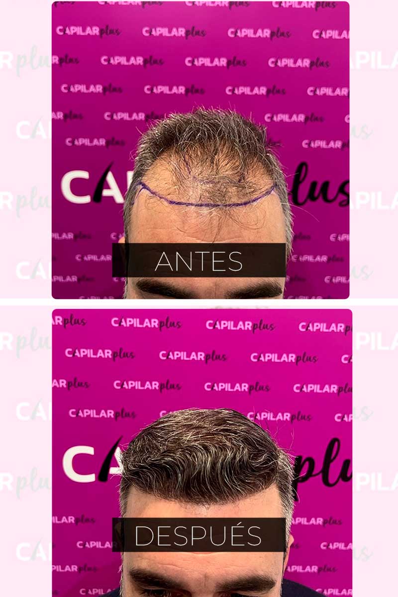 CLINICA CAPILAR SEVILLA